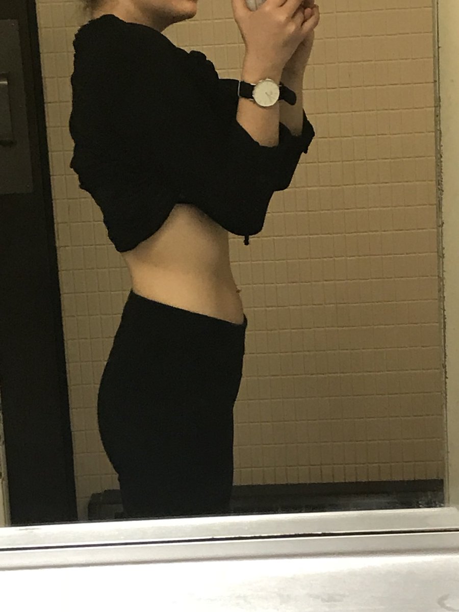 Ana_xSophie's tweet image. I’m at risk for IP even though my ribs don’t even show. And I’m close to a thigh gap, but don’t have it yet. And look how bloated and disgusting I still am? Like idgi #bodycheck #EDproblems