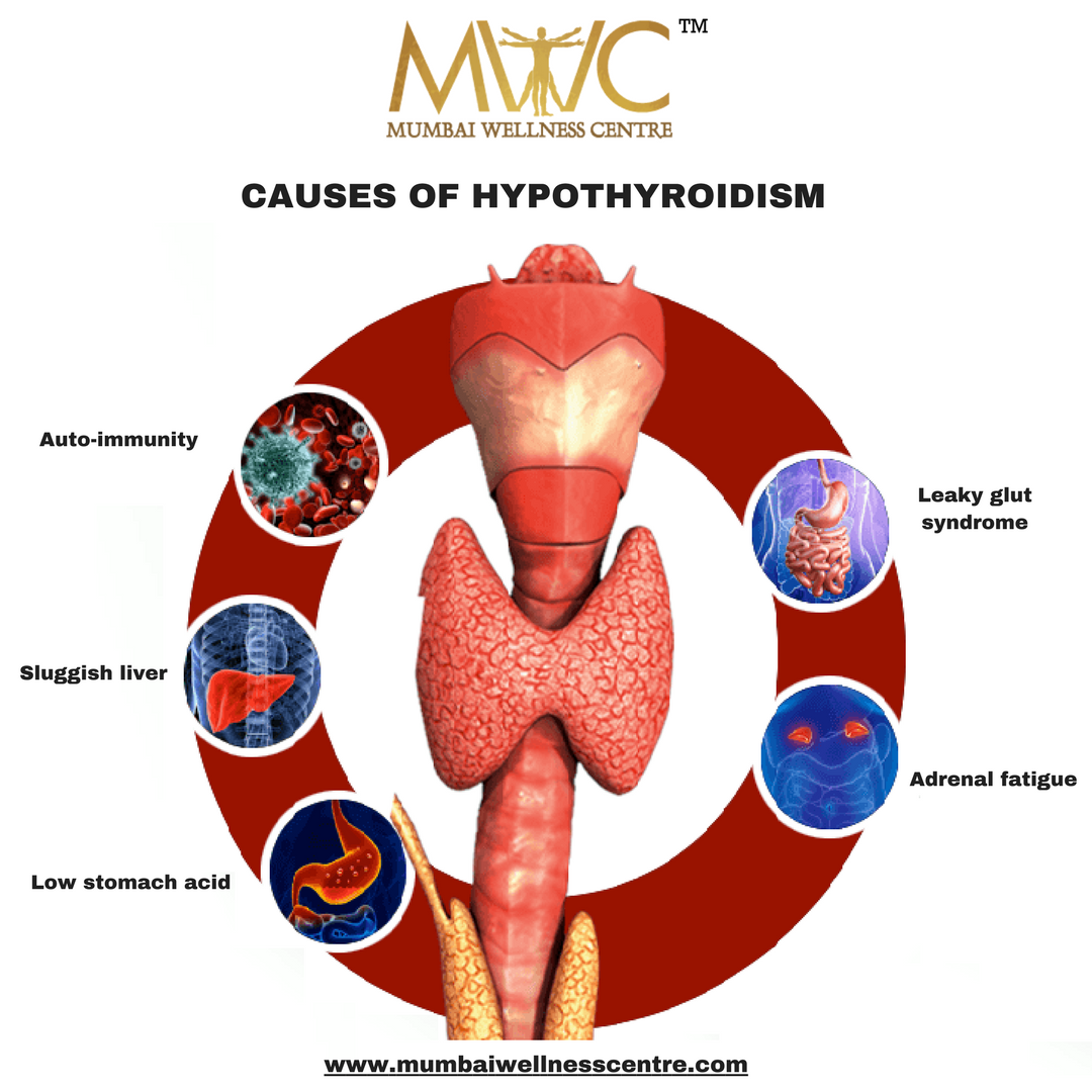 MWellnessCentre's tweet photo. Hypothyroidism is a condition that occurs when your thyroid gland doesn't produce enough thyroid hormones. #MWC #mumbaiwellnesscentre #mumbaiwellness #thyroid #thyroidgland #thyroidtreatment #thyroiddisease #thyroidcancer #thyroidproblems #thyroidissue #thyroidsurgery https://t.co/8WJObZ54oN