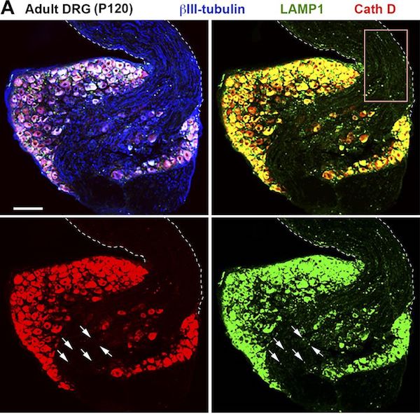 JCellBiol's tweet photo. Cheng et al @NINDSnews show that, in neurons, a significant portion of LAMP1-positive organelles are not degradative, illustrating the need for additional markers to define endolysosomal compartments in the nervous system https://t.co/VNC75W7LQh https://t.co/DVRyBgBrGE