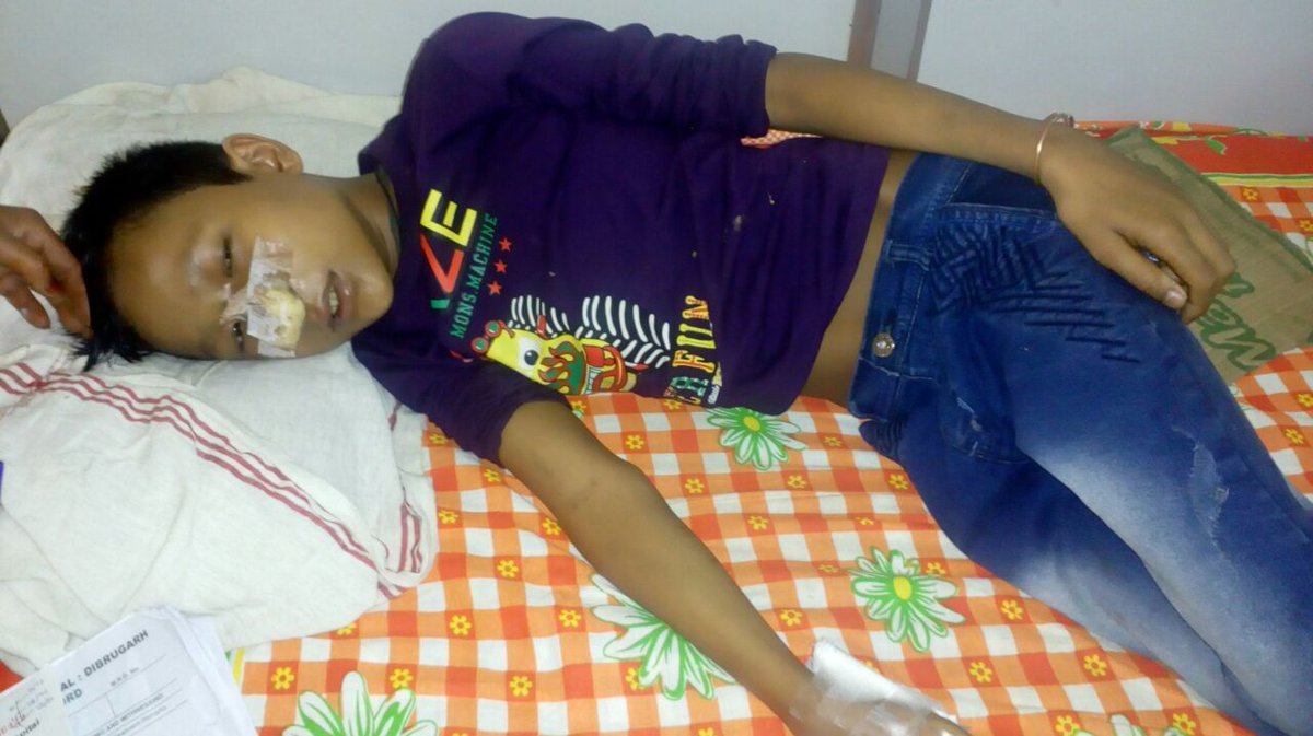 SouleFacts's tweet photo. This kid Deep Sonowal needs immediate Bone Marrow transplant, admitted in Children Ward of Assam Medical College. In Assam there is no such facility for treatment, and outside the treatment may cost 30 Lac+, need ur attention &amp; financial help. Any helping hand will be God's help. https://t.co/feFsTvBfG0