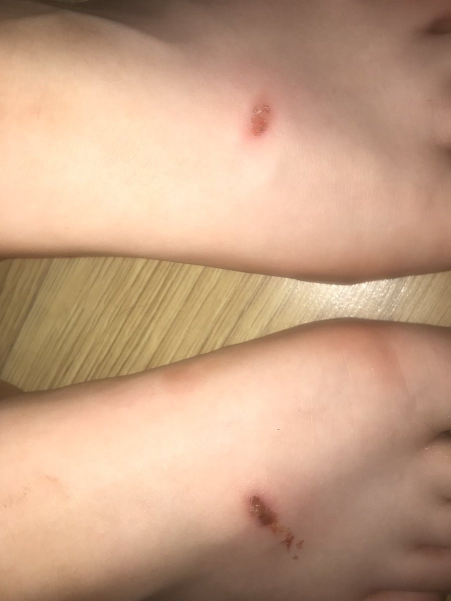 katylaurarose's tweet photo. @Primark wore these shoes for a few hours and I now have deep cuts on my feet 👌🏻👌🏻👌🏻 https://t.co/0lusuYZPui