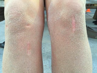damnnolan's tweet photo. The sand doesn’t stick to my wife’s scars. https://t.co/Uu2THnK3It