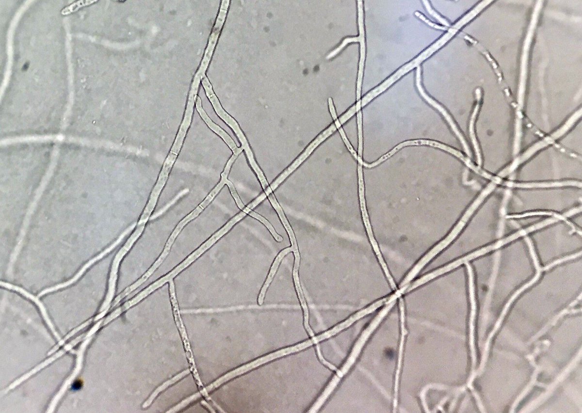 Rhizoctonia solani recovered from diseased #tobacco seedlings. Sanitizing  float bed trays is crucial for management. #mycology #microscopy  #plantdisease