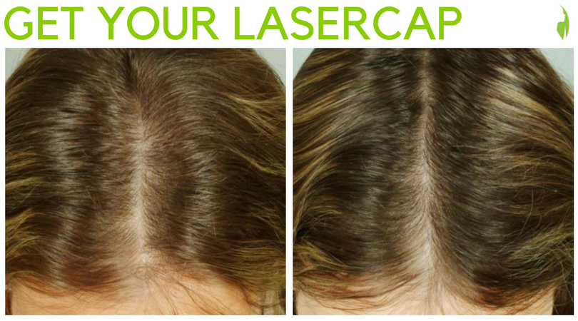 PrincetonMD's tweet photo. Growing up shouldn't just be a long road of thinning hair. #LaserCap triggers hair growth and is your right-hand woman or man for a lifetime of full, #luscioushair. @LasercapCompany https://t.co/TGuEc4N9VX https://t.co/UIW6nGrFCN