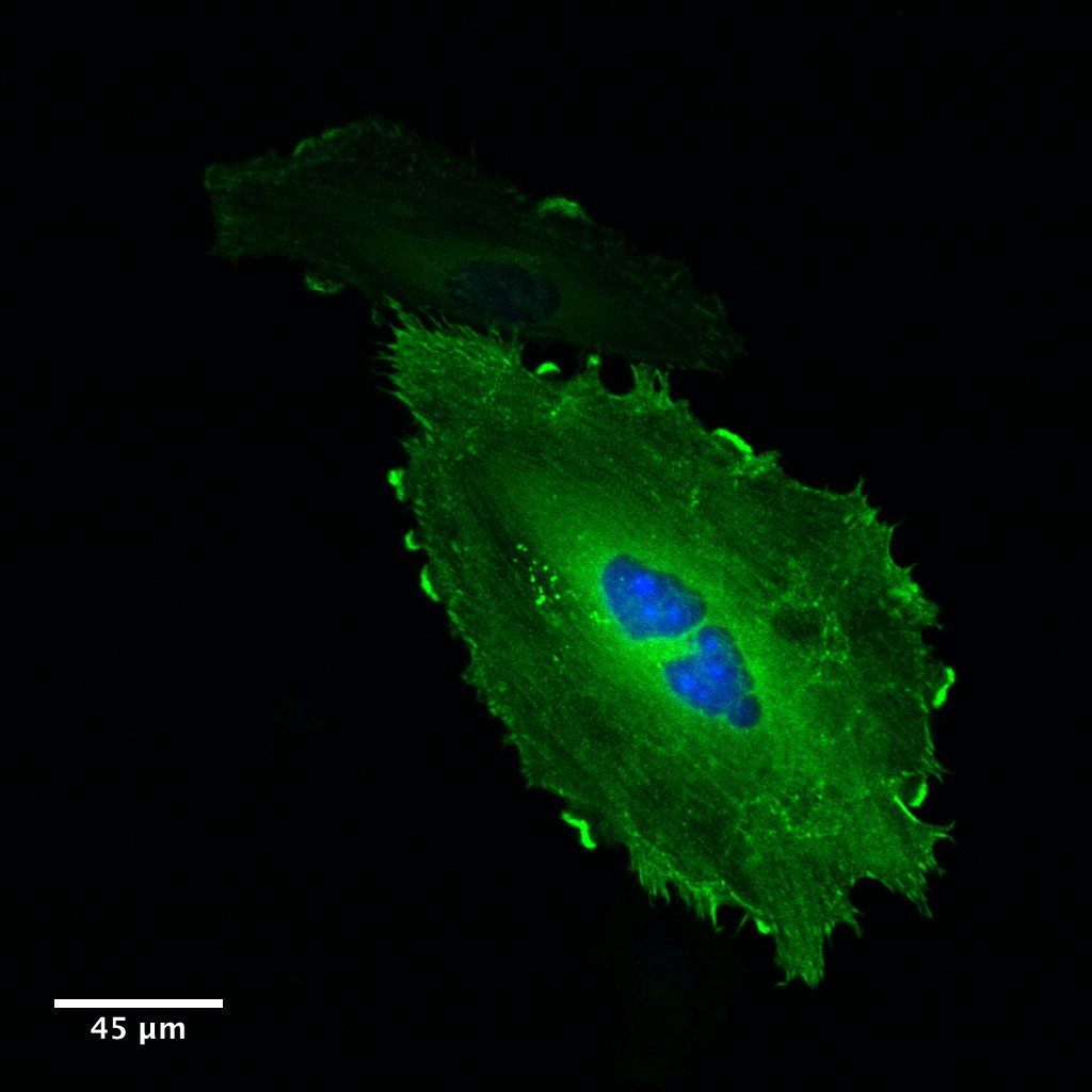 jidiculous's tweet photo. absolute unit – this HEK cell transfected with ACTN4-EGFP and NLS-EBFP is 215.91 µm end-to-end. In comparison, the diameter of a human hair ranges from 17-181 µm #SciArt https://t.co/ViswsgAUMx