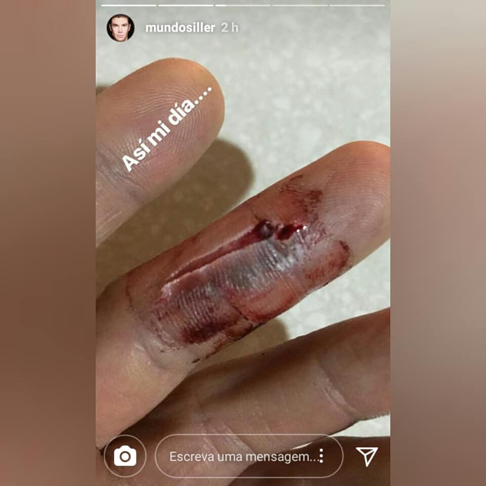 BrasilSiller's tweet photo. #Repost @MUNDOSILLER vía #instagramstories #mundosiller 
Que se recupere pronto Amado  💚😘😘😘 https://t.co/7fhB5bscBI