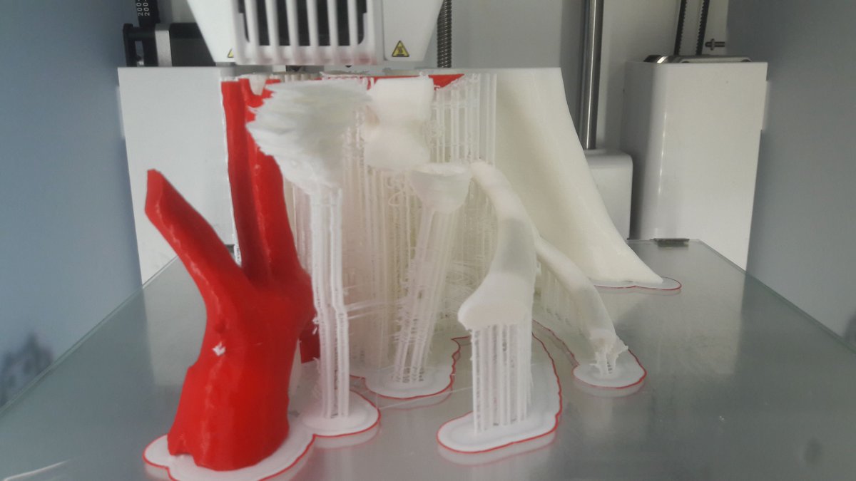 3DGabBME's tweet photo. As said before, different obstacles ⚒ had to be overcome during this 3D print, especially when trying to use double extrusion. 
Under-extrusion occured several times, but the stability of the collarbone's helpers was the most challenging one. https://t.co/ErKnZlOahv