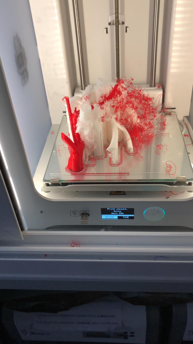 3DGabBME's tweet photo. As said before, different obstacles ⚒ had to be overcome during this 3D print, especially when trying to use double extrusion. 
Under-extrusion occured several times, but the stability of the collarbone's helpers was the most challenging one. https://t.co/ErKnZlOahv