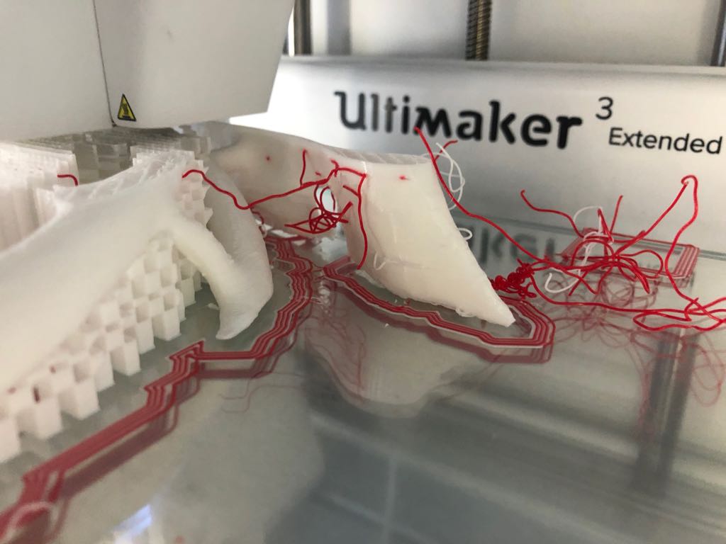 3DGabBME's tweet photo. As said before, different obstacles ⚒ had to be overcome during this 3D print, especially when trying to use double extrusion. 
Under-extrusion occured several times, but the stability of the collarbone's helpers was the most challenging one. https://t.co/ErKnZlOahv