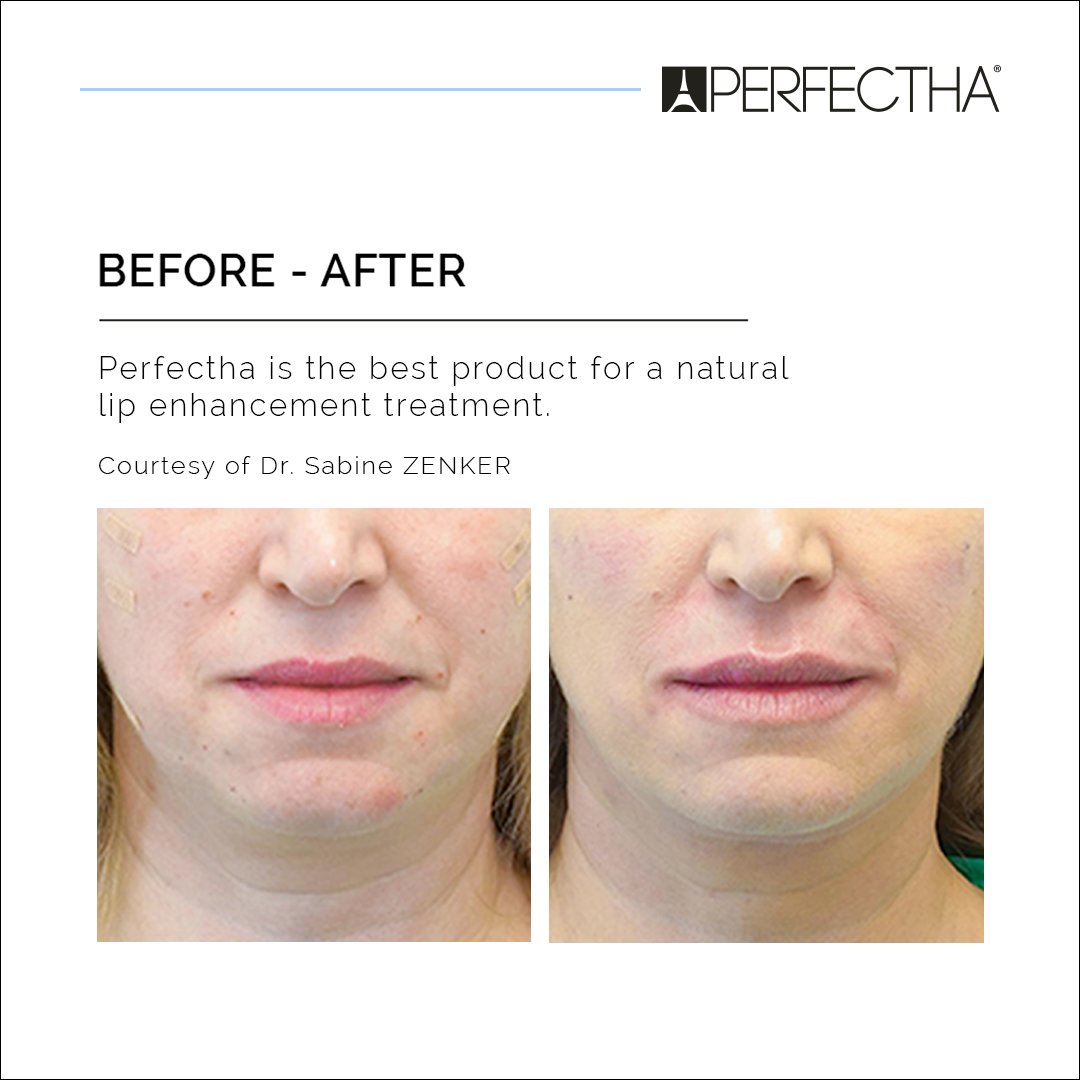 Perfectha Global tweet media