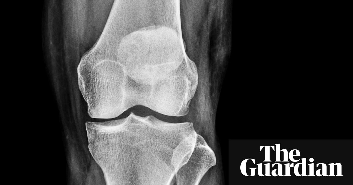 While factors such as #age and #gender affect your chances of getting osteoporosis, there are many lifestyle changes you can make to reduce the risk, such as weight bearing #exercise ow.ly/Xxsy30jUhq0