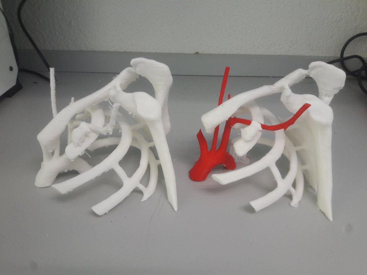 3DGabBME's tweet photo. At the end, double extrusion was achieved.
Future goal: same model printed with TPU-95 or SmartFlex for blood vesels and E.P. or PLA for bones. @3d_maranon @rupermac @calvoharo_ja @CharlieMonitor @Ultimaker https://t.co/JWka7UeAE9
