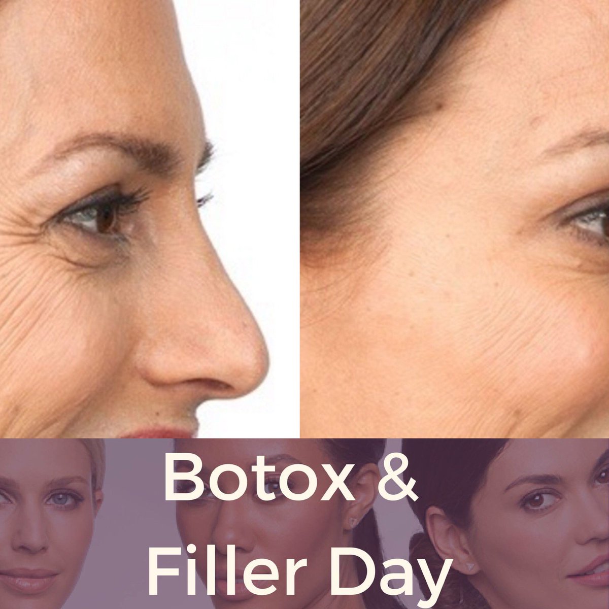HealingBeautyC's tweet photo. Take advantage of our special this Friday and SAVE $200 on #botox. Book today, space is limited!
519-653-1991 reception@healingbeautyclinic.com

#botox #dysport #filler #beauty #you #face #lines #wrinkles #wrawesome #cbridge #clinic #rn https://t.co/MqzURWMicw