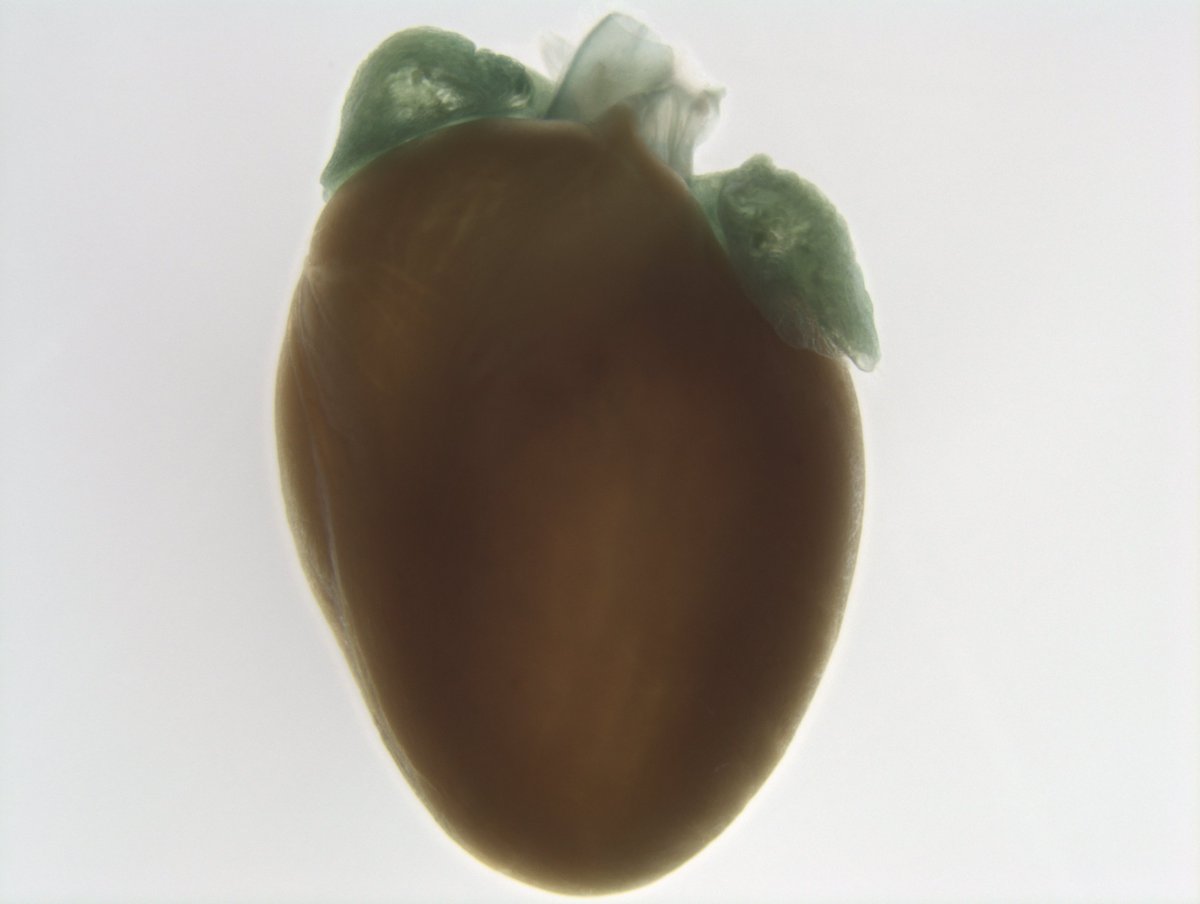 impc's tweet photo. Todayβs #GeneOfTheDay is #Coq2. Full name: coenzyme Q2 4-hydroxybenzoate polyprenyltransferase; Knockout phenotype associations include preweaning lethality & decreased circulating amylase level. Human disease models include Coenzyme Q10 Deficiency. https://t.co/wYu0jZ6lZx https://t.co/KKIlJFTBkd