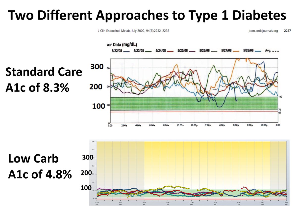 download seizures in cerebrovascular disorders