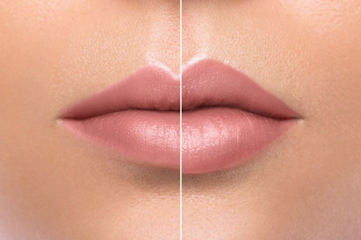 botanicalbeaut's tweet photo. Our Botox &amp; Fillers specialist will be coming to the salon again on the 16th May between 6pm &amp; 8pm. If you would like to have a consultation or treatment, please contact us and we can book you an appointment for that evening.

#Botox #dermal #fillers #antiaging #beauties https://t.co/GCrmUgm90o