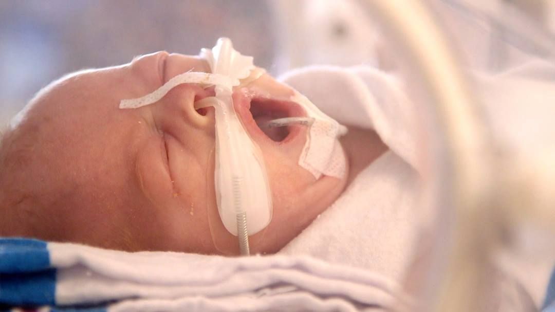 PebblesOfHope's tweet photo. An amazing story giving an inside look into the life of a NICU nurse. We thank you for all that you do! #NursesWeek
https://t.co/T8mx9QtqQT https://t.co/Nd6teBxFeA