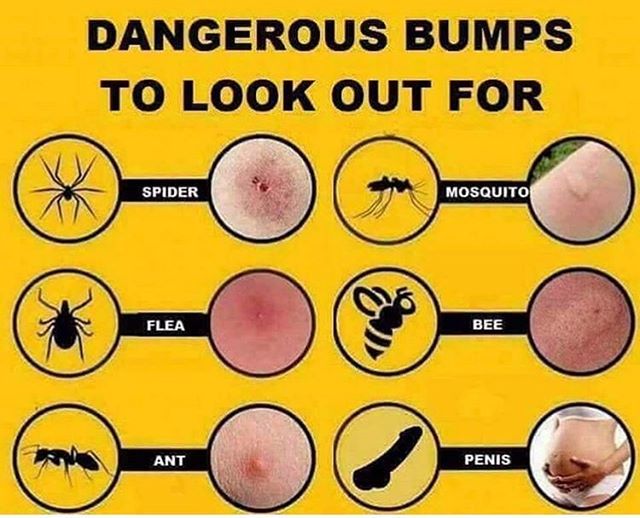 🚫🛑❗️#warning dangerous bumps #gross #lol #comment #share #followforfollow #scaryprick ❗️🛑🚫 ift.tt/2jJQ3XR