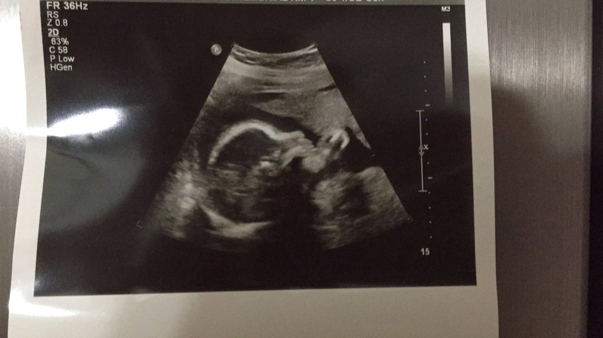 ThatOneGuyy33's tweet photo. Absolutely surrounded by girls, but I wouldn’t trade it for the world. 10 weeks until you’re here baby girl and you best believe mommy and I can’t wait to meet you. ❤️ https://t.co/3Cmt1yCiUi