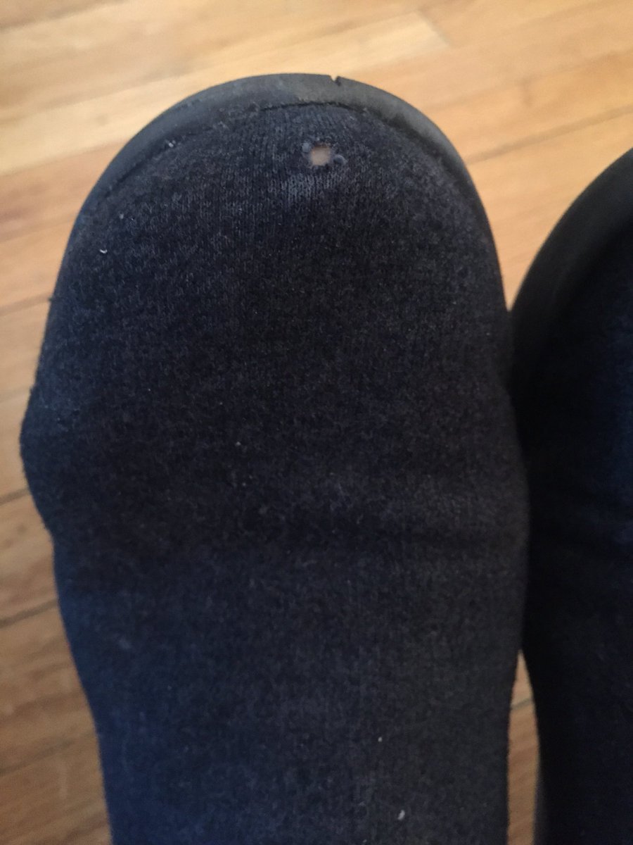 allbirds hole in toe