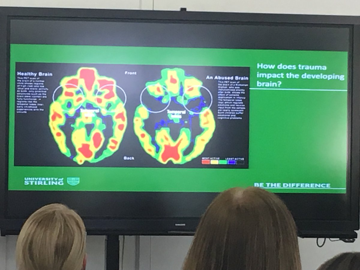 Lauren8McA's tweet photo. Neural basis of #trauma on #children decontextualises impact of #domesticviolence  #trauma  #ccwpconf  @JaneEMCallaghan https://t.co/DSq0zTsl13