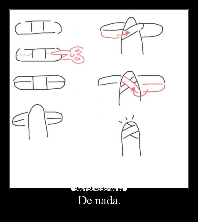 mindsmedia's tweet photo. @mundowdg Hack the finger! https://t.co/AlTAvg46Su