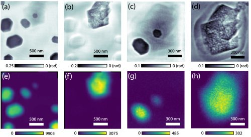 read quantitative coronary angiography in clinical practice