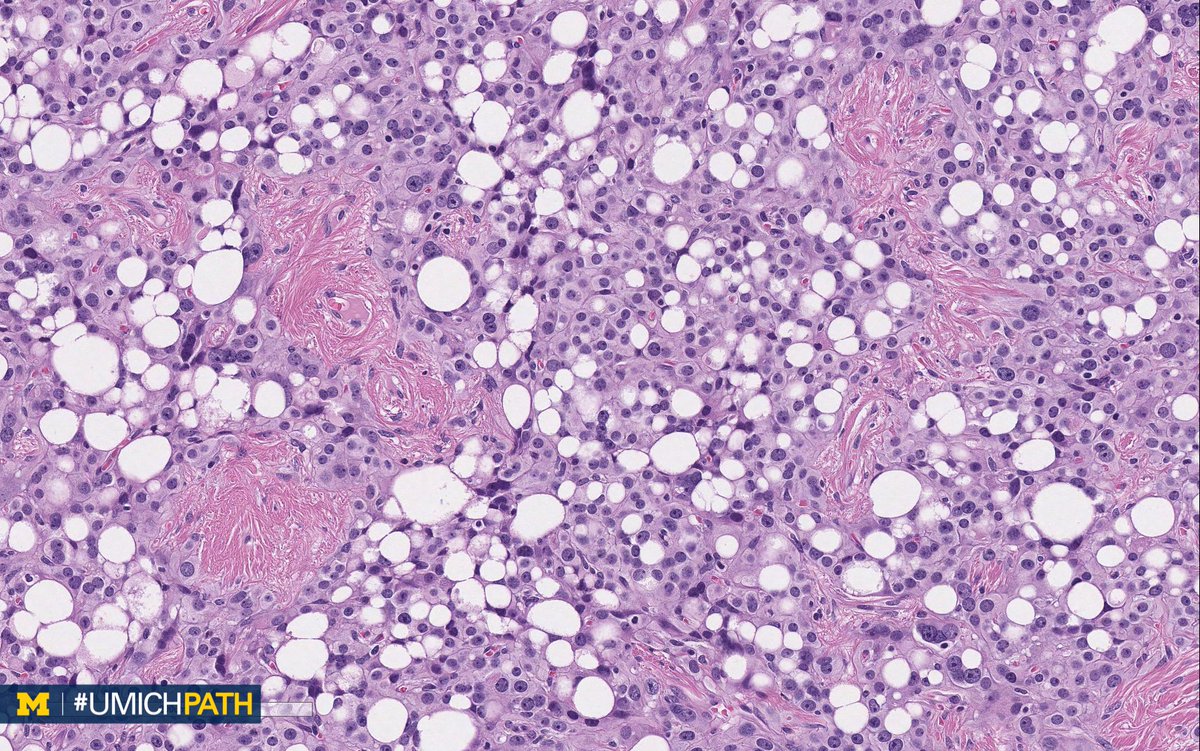 Michigan Pathology tweet media