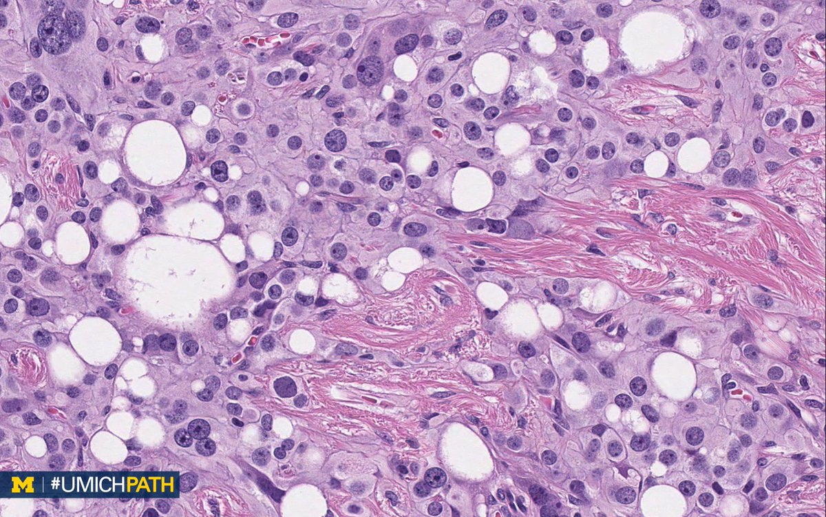 Michigan Pathology tweet media