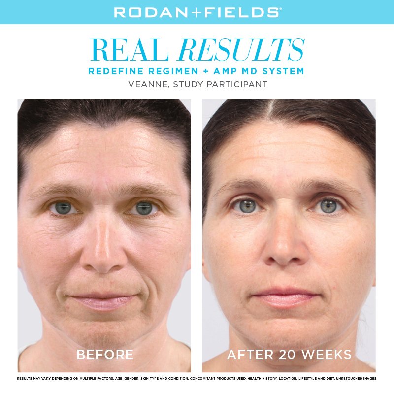 Hayes10Rhonda's tweet image. Look in the mirror. Are you worried about fine lines and wrinkles? #ampupyourresults #redefineregimen #babysoftskin
