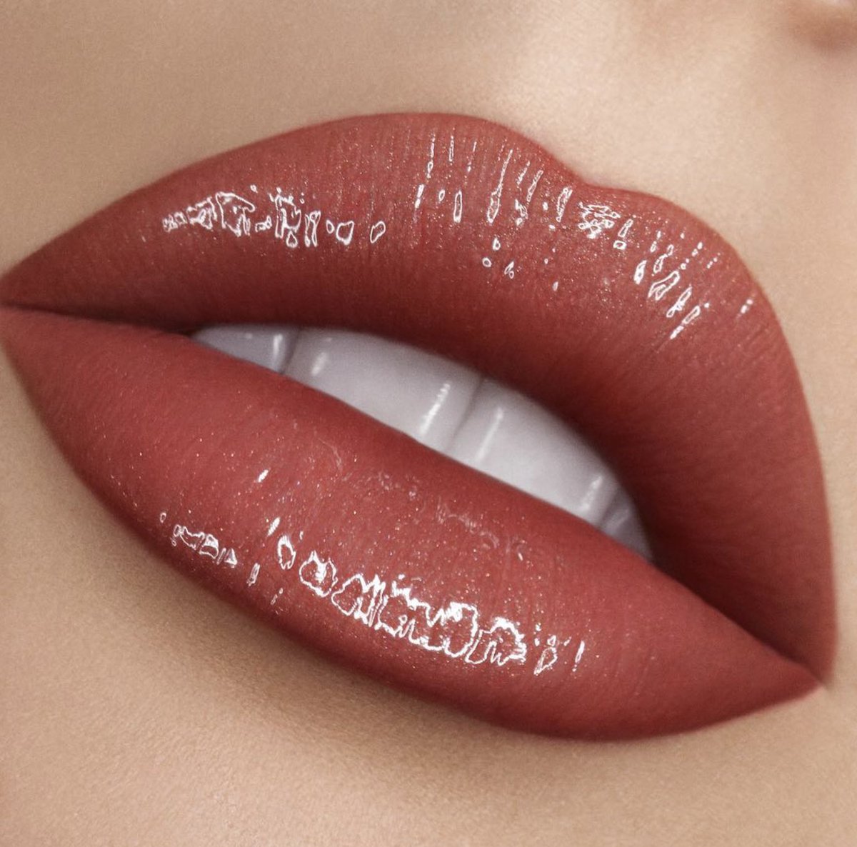 Fallen lips