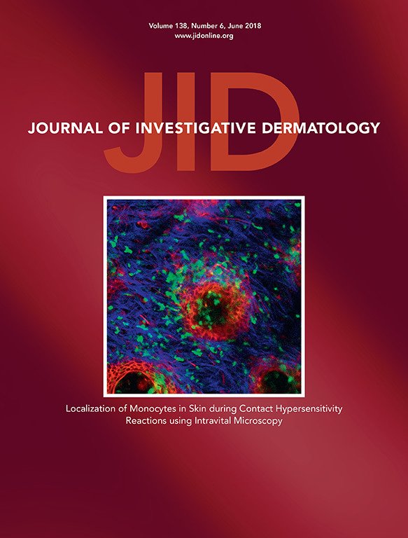 StanfordSurgery's tweet photo. New from @StanfordPlastic's #HageyLab & @GeoffreyGurtner: Controlled Delivery of a Focal Adhesion Kinase Inhibitor Results in Accelerated Wound Closure with Decreased Scar Formation https://t.co/0aCj8CDIYN #woundhealing via @JIDJournal https://t.co/cw93l5Ex5A