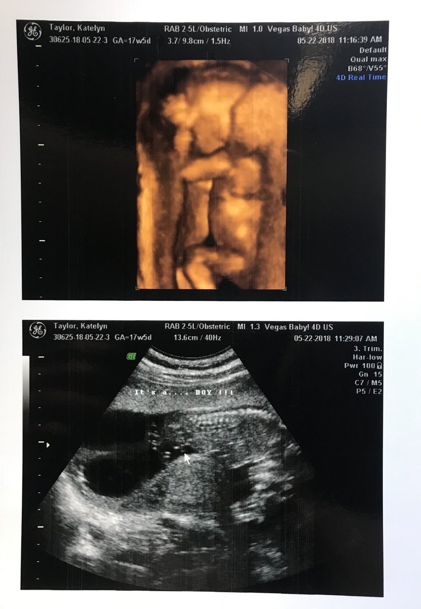 Isaacwilson_98's tweet photo. Daddy can’t wait to meet you baby boy💙🍼 I promise you I will do everything I gotta do to be the man you need in this world. Oct.25 see you soon young boy! https://t.co/i34jt4R6r8