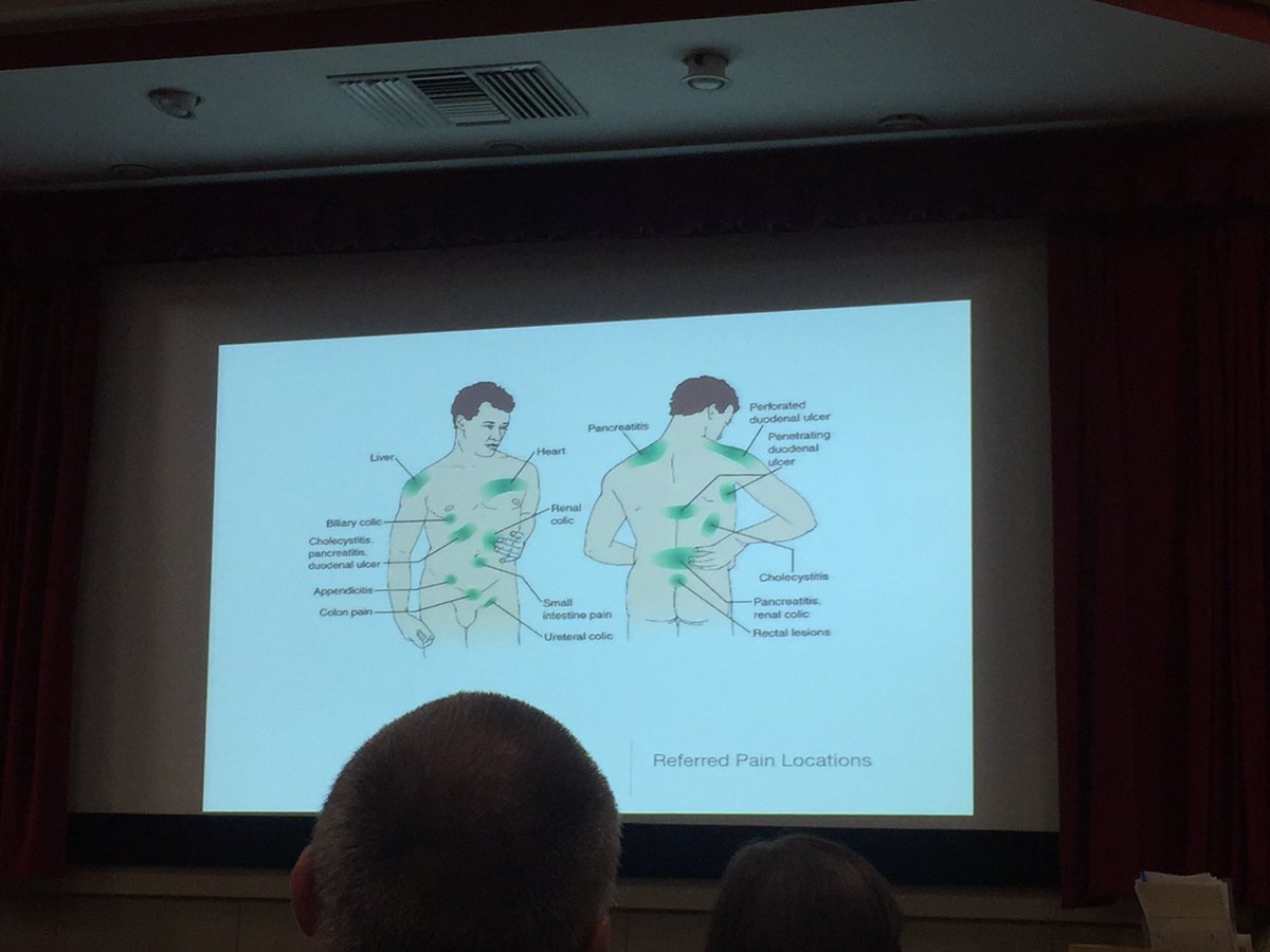 At the @EoEACP_FOAM #acptrainingday. Learning about the acute abdomen from Mr Tutton. @MelissaD_CHUFT @ColchesterNHSFT