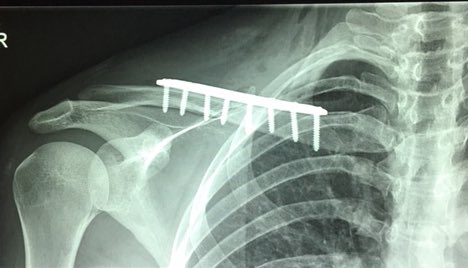 Jolien D'hoore tweet media