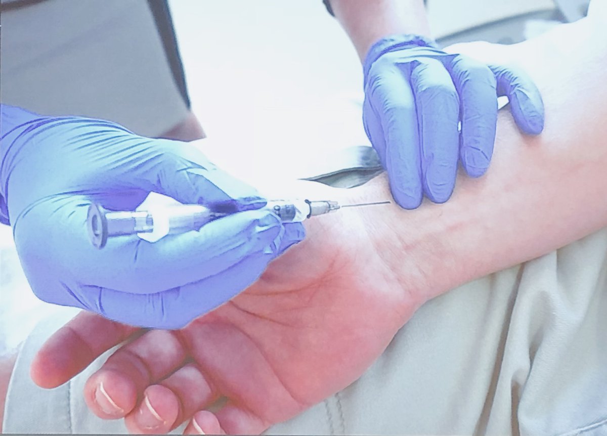 TamingtheSRU's tweet photo. When should you get an ABG instead of VBG?

1) Need to assess pO2
2) Extreme hypercarbia 
3) Methemoglobinemia
4) Need exact measurement of acid-base status
5) they already have an a-line

#EMConf https://t.co/tuMXQX3aXL