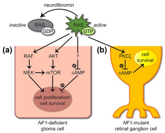 Neuroscience's tweet photo. A new review discuss the pathobiology of optic pathway glioma (OPG) in individuals with neurofibromatosis type 1 (NF1), including possible mechanisms of NF1‐associated OPG (NF1‐OPG)‐related vision loss https://t.co/c1kFDcj1Lj https://t.co/Uu9fjovzUs