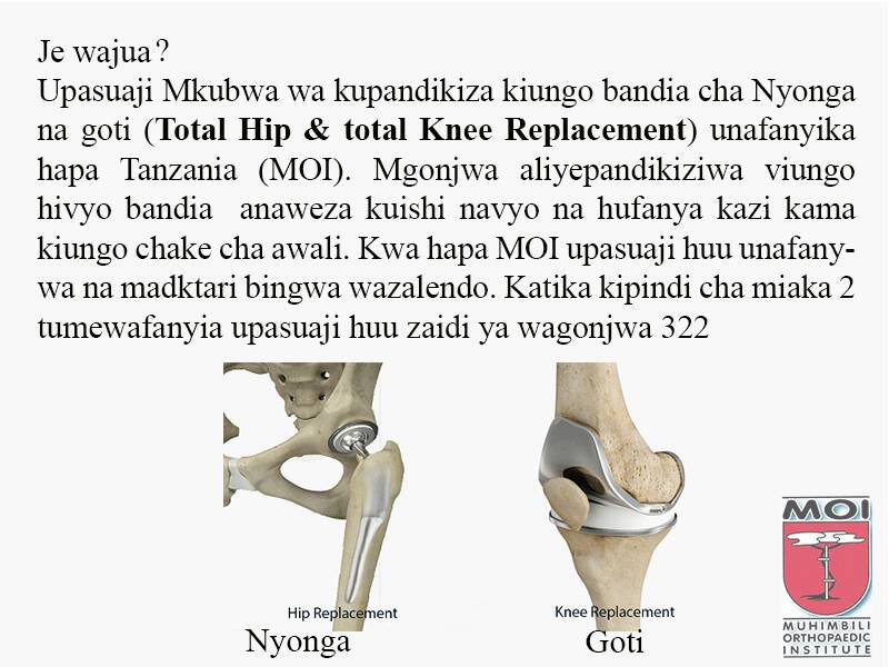 Je wajua?
Upasuaji mkubwa wa kupandikiza Kiungo bandia cha nyonga na goti unafanyika hapa Tanzania.