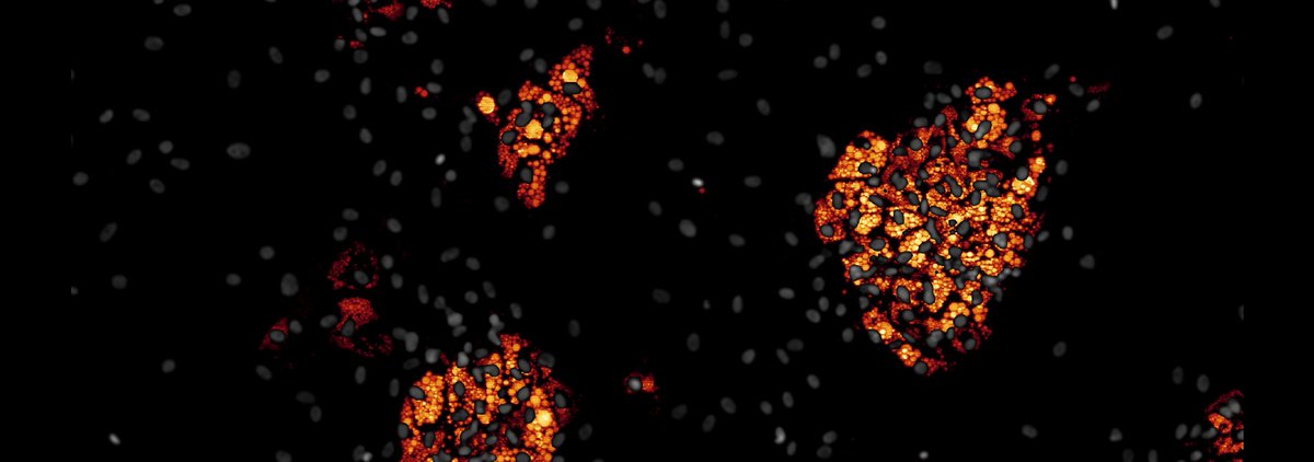 En cette journée européenne de lutte contre l'#Obésité, voici quelques éléments pour changer son regard sur le #tissuadipeux, souvent pointé du doigt et pourtant nécessaire au bon fonctionnement du corps humain. "Vices et Vertus du #Gras" => linkedin.com/pulse/vices-et… #adiposetissue