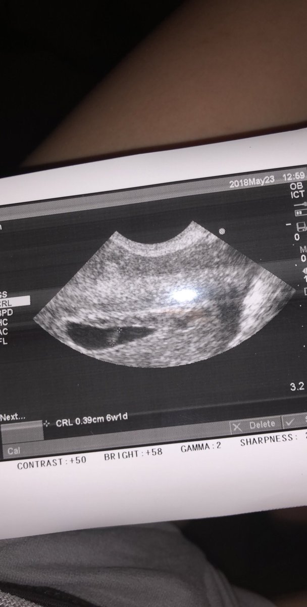 tgrindle_797's tweet photo. I’m gonna be a dad 😁 https://t.co/ceqFYIvGHV