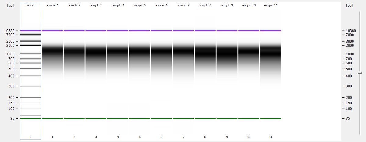 danieljhurley_'s tweet photo. Promising early signs for our @illumina #MiSeq run. @NEBiolabs Ultra II FS DNA library prep with average fragment size >1 kbp. Quality control using @AgilentGenomics #Bioanalyzer https://t.co/JEbZT8x0wm