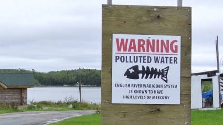 Grassy Narrows releases health study LIVE ift.tt/2s5w5eN