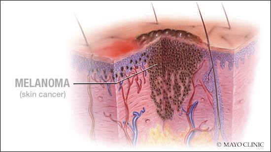 view pancreas and islet transplantation