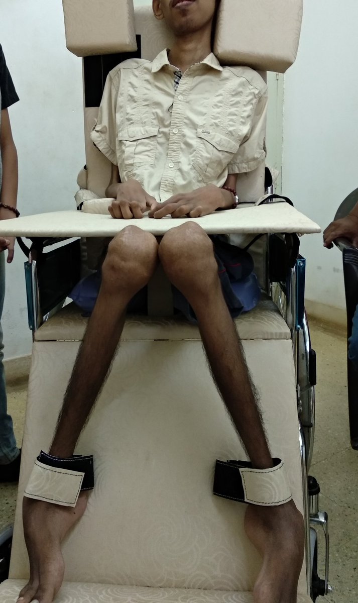 childortho's tweet photo. Custom cheap #WheelChair #mobility is a challenge for any #CerebralPalsy clinic in developing nation where cost is a constraint . At #ICCONS we are involving local Craftsman to convert regular wheelchair for the children. Still work in progress ....
@Global__Help
@AskDrLana https://t.co/nGHWtKayql