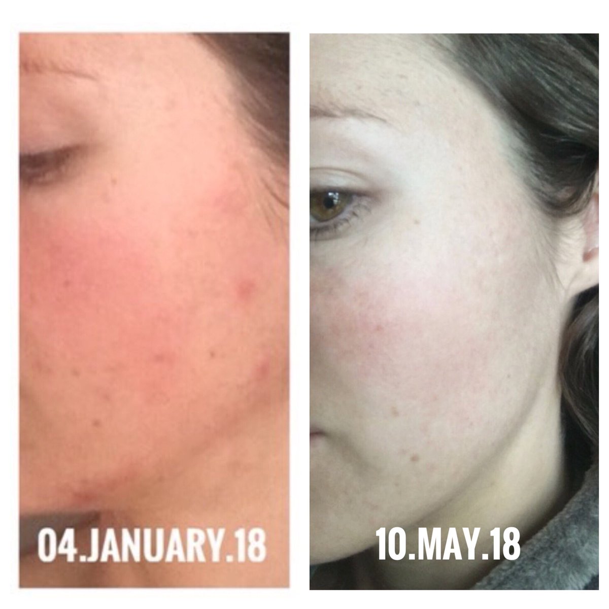 era organics face cream