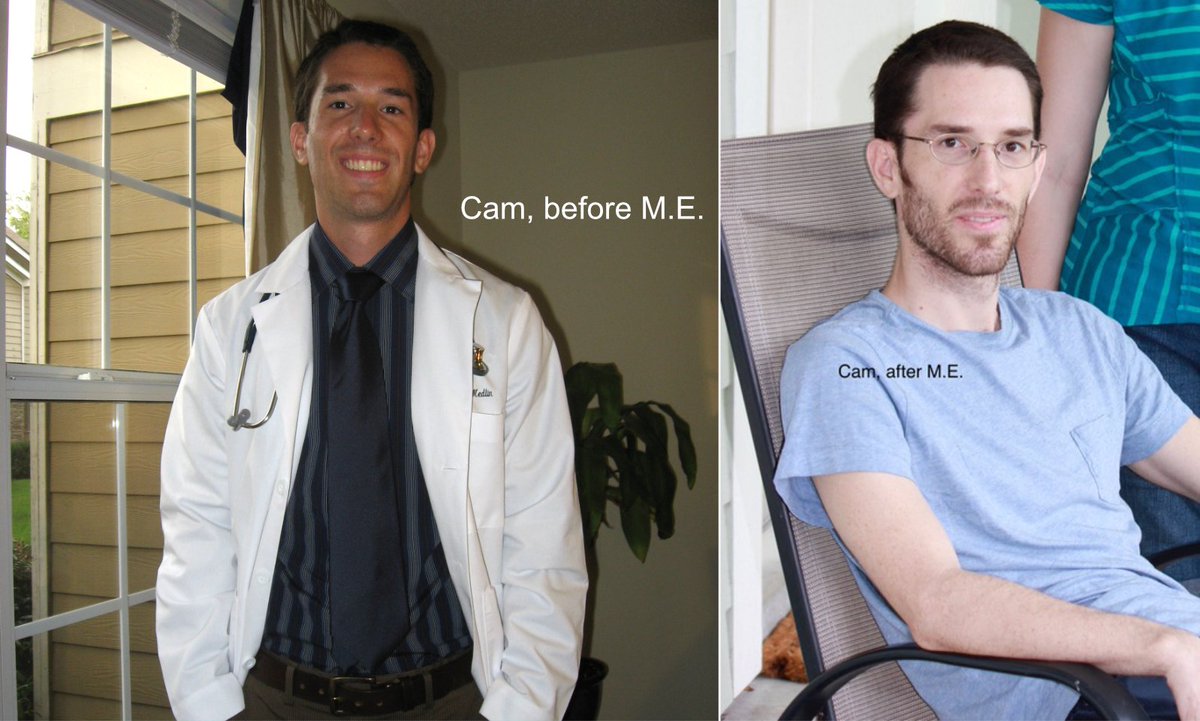 cammedlin's tweet photo. This is me before and after M.E. Still an #invisibleillness? #MillionsMissing #MECFS https://t.co/OhE9AT7mSw