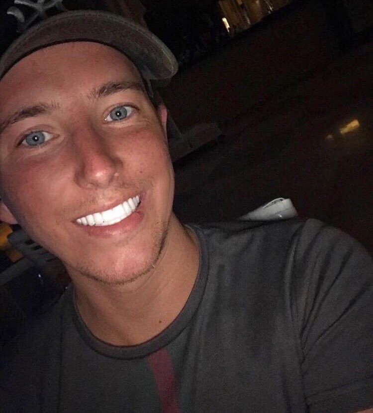 Some Of This Weeks Smile Makeovers Done By The Amazing &amp; Very Talented Sevil @sevilsmilestudio DM Now For Info