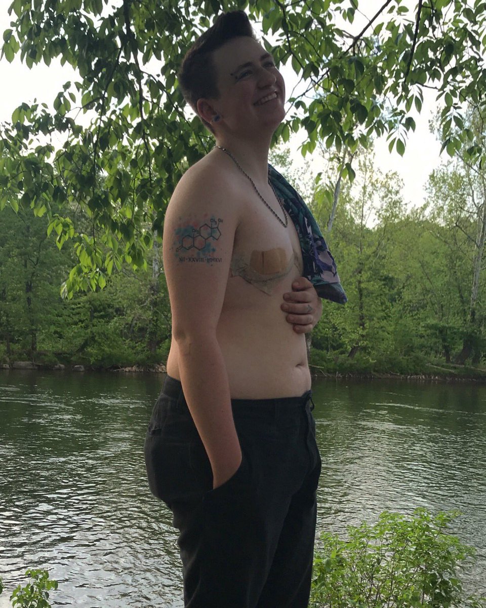 bryceeearoni's tweet photo. Shirtless for the first time in public since I was a kid and before I went through the incorrect puberty. I’m finally becoming comfortable in this body.🤟🏻😊 #ftm #trans #transgender #transftm #topsurgery #doubleincision #transman https://t.co/QuXduYpEzv