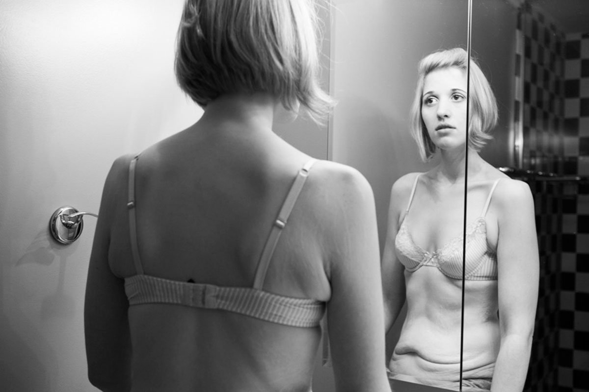 smoda's tweet photo. Después de perder peso, la pesadilla continúa https://t.co/H5bsEfq3VQ https://t.co/QuCmLHjDBY