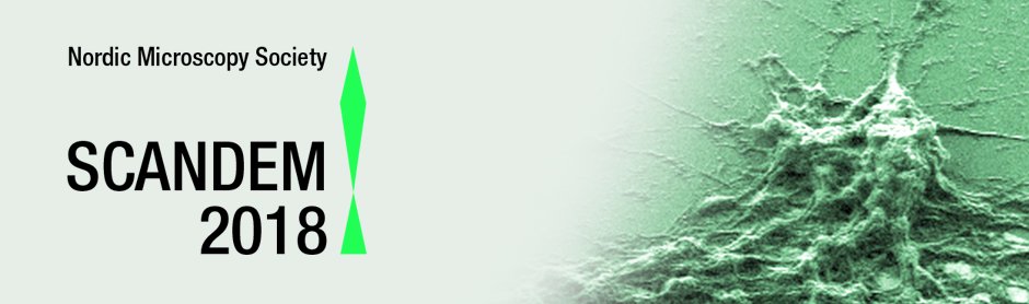 MEDIASystemLab's tweet photo. Do you know MEDIA System Lab will be at Scandem18? Yes we'll be there! https://t.co/6kkq3TEoe2 #ILoveMySEM #Scandem18 #DTU #scanningelectronmicroscopy https://t.co/swR535kqJx